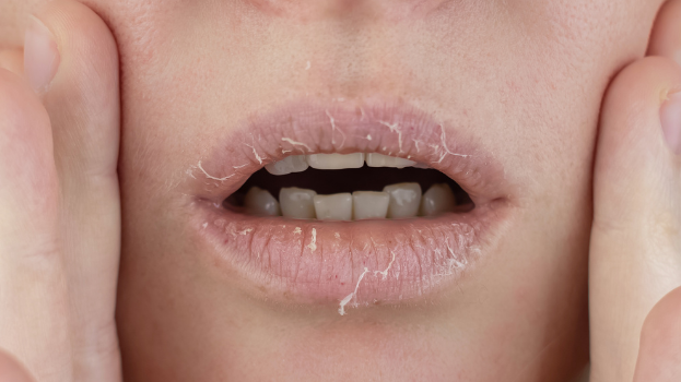 Dryness or Tightness After Using Toner? Here’s Why It Happens and How to Fix It