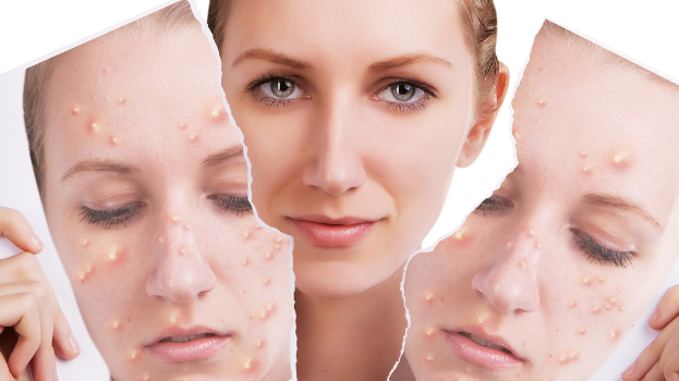 The Real Reason Your Skin Looks Dull and Pores Keep Clogging?