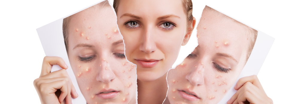 The Real Reason Your Skin Looks Dull and Pores Keep Clogging?