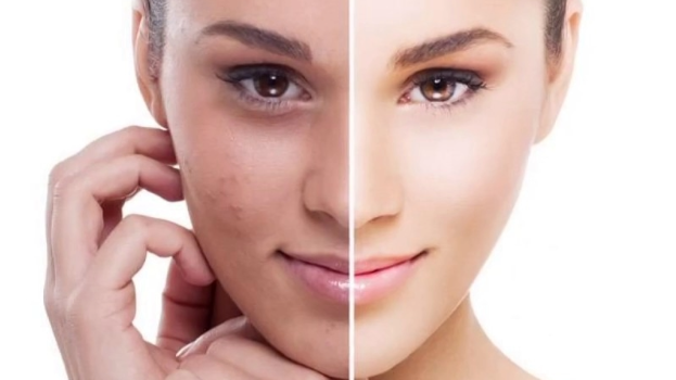 Skincare Struggles Solved: Fixing Rough Skin, Dullness, and Poor Product Absorption