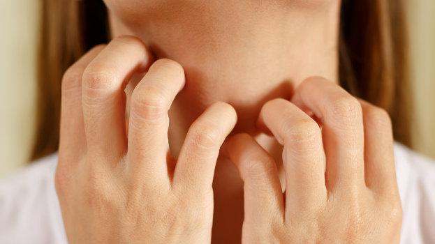 When Your Skin Says No: Smart Ways to Handle Irritation and Allergic Reactions Naturally