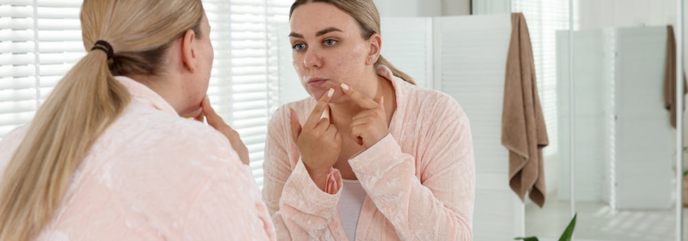 When Your Skin Overproduces Oil: Understanding the Battle with Clogged Pores