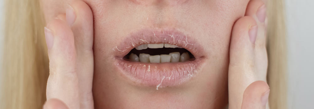 Dryness or Tightness After Using Toner? Here’s Why It Happens and How to Fix It