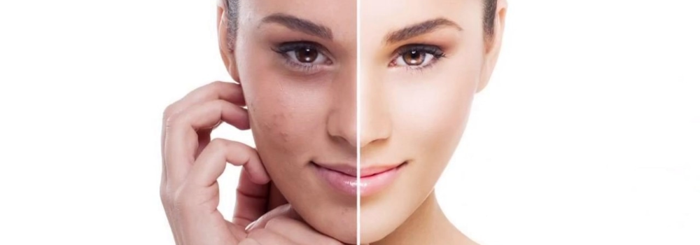 Skincare Struggles Solved: Fixing Rough Skin, Dullness, and Poor Product Absorption